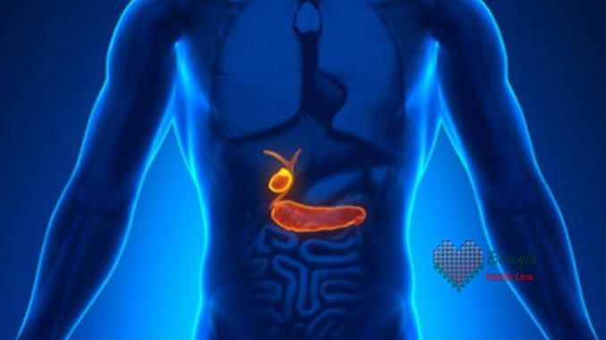 পিত্তথলিতে পাথর হলে কি করবেন?