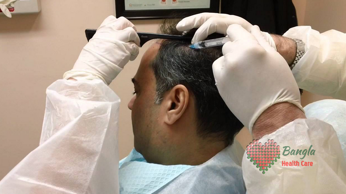 চুলের চিকিৎসায় পিআরপি