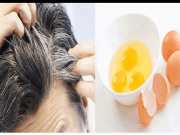 চুলের অকালপক্বতা রোধের ঘরোয়া উপায় চুলের অকালপক্বতা রোধের ঘরোয়া উপায়