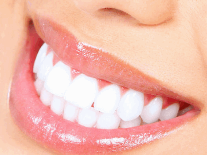 দাঁত সাদা বানাবেন যেভাবে