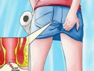 পাইলসের সমস্যায় কিছু নির্দিষ্ট খাবারও দারুন উপকারি, জেনে নিন বিস্তারিত