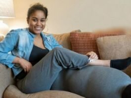 এক পায়ের ওজন ৪৫ কেজি, বিরল অ’সুখ নিয়েও তিনি জনপ্রিয় মডেল